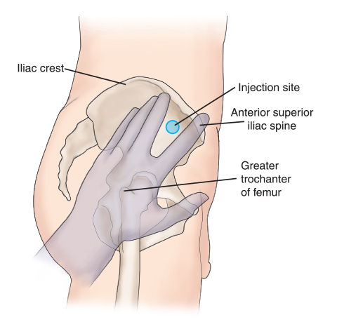 Ventrogluteal injection site