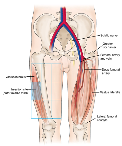 Vastus lateralis injection site
