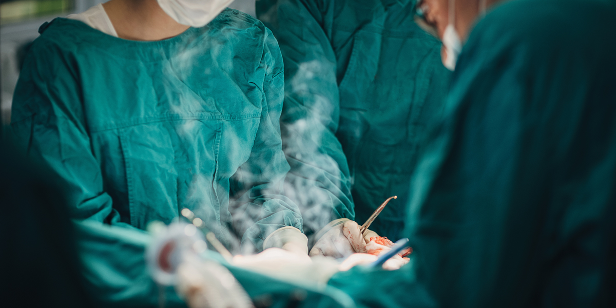 ADVOCACY SPOTLIGHT Surgical Smoke Evacuation Laws Spread across the
