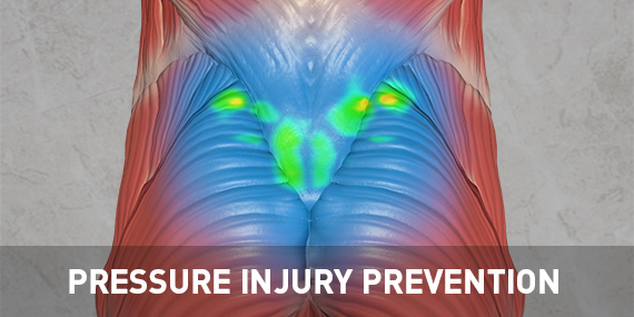 Pressure Injury Prevention