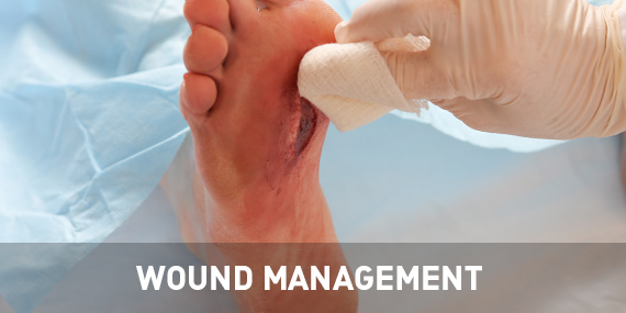 Wound Management
