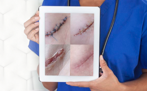 Undisturbed Wound Healing CE