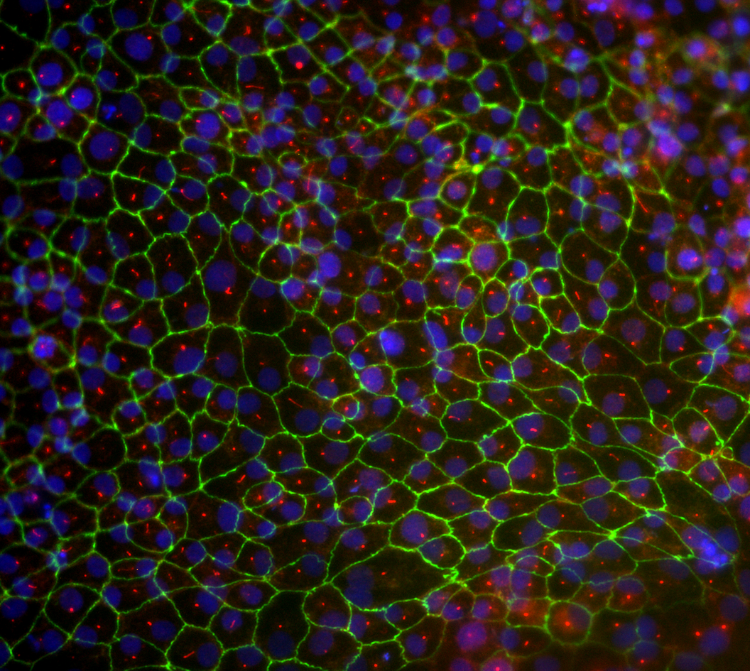 Your submission image