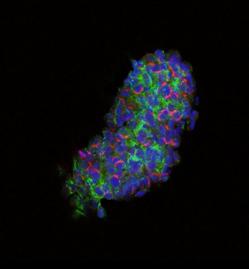 Your submission image