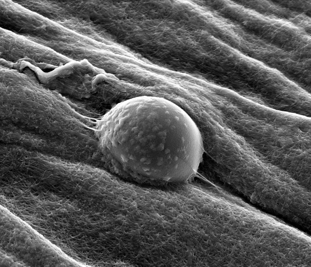 Your submission image