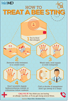 Treating a Bee Sting
