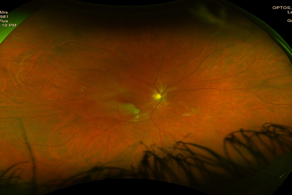 A close up of a microscope AI-generated content may be incorrect.