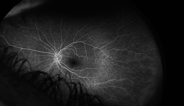 A close-up of a light AI-generated content may be incorrect.