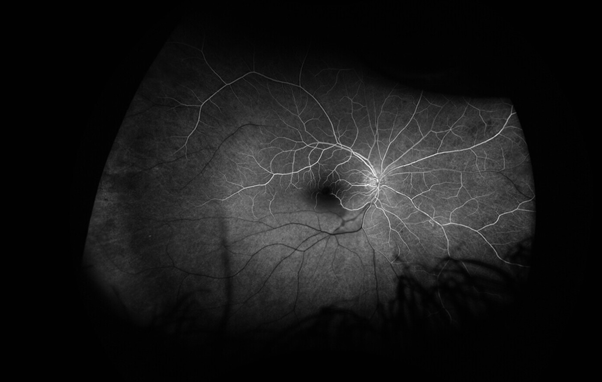 A close-up of a human body AI-generated content may be incorrect.