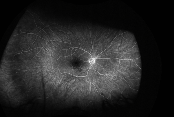 A close-up of a vein AI-generated content may be incorrect.