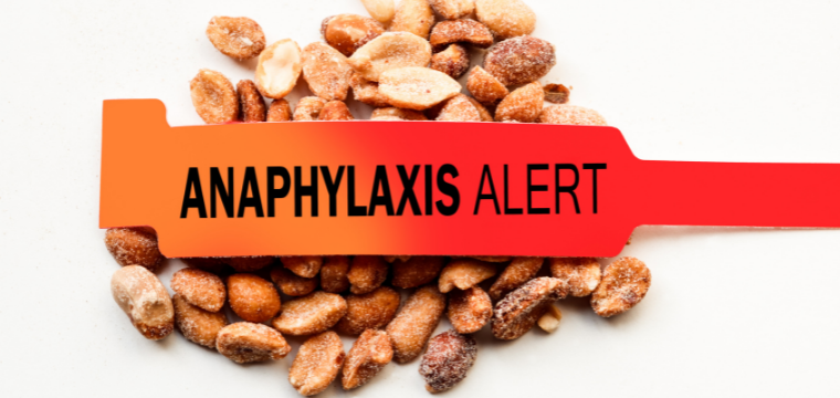 Allergies and Anaphylaxis