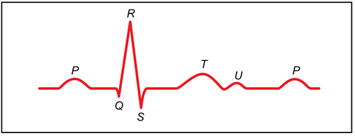 CVM Chapter_Figure 6_Parts of ECG Waveform