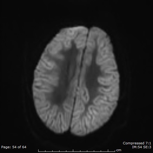 Figure 10_A