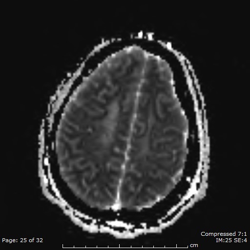 Figure 10_B