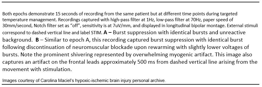 Figure 8_1_Abnormal Variability_Identical Bursts
