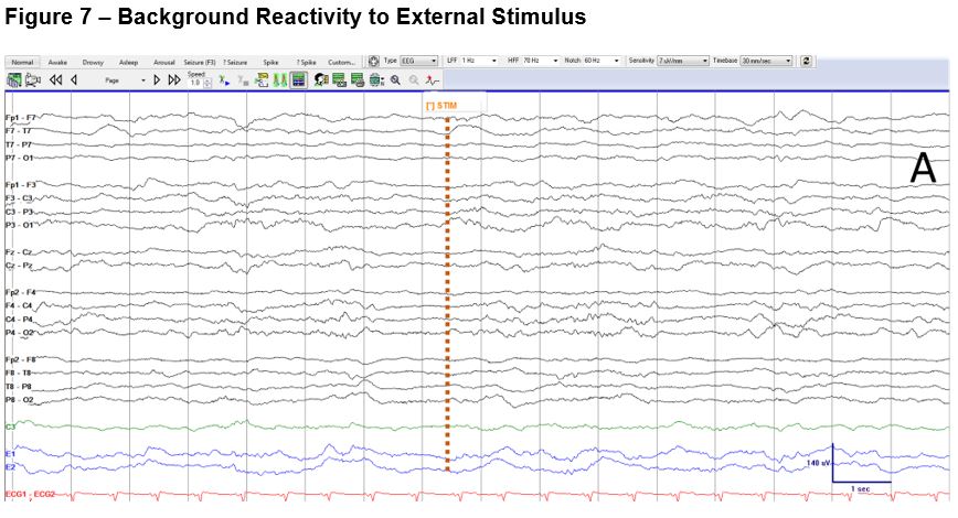Figure 7_External Stimulus