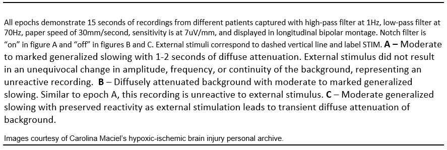 Figure 7_External Stimulus