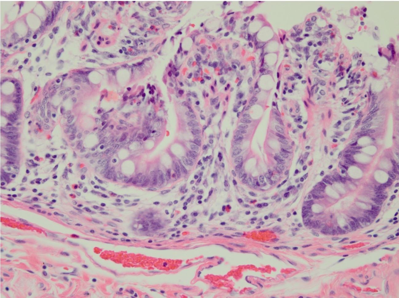 Troubleshooting Histology