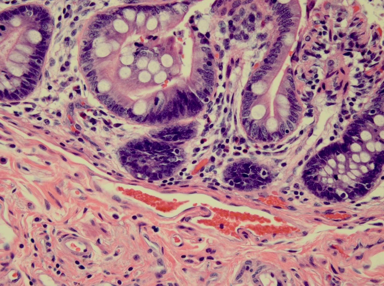 Troubleshooting Histology