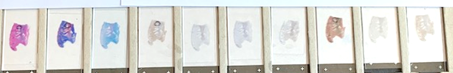 Tissue Orientation
