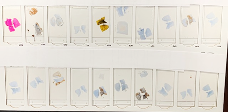 The Importance of Tissue Orientation