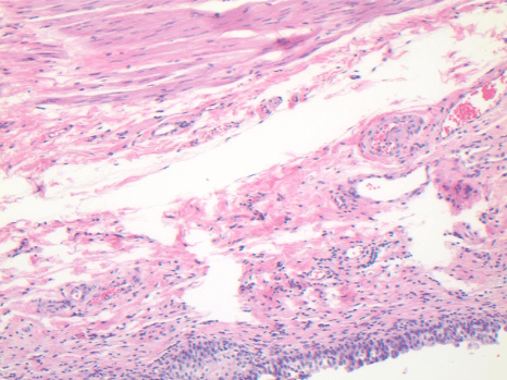 Alternatives to Hematoxylin