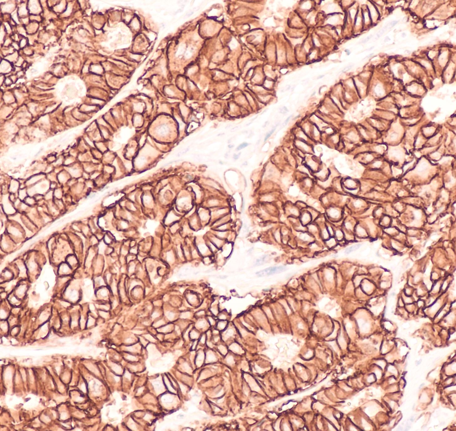 Antigen Retrieval: The Importance of Pretreatments