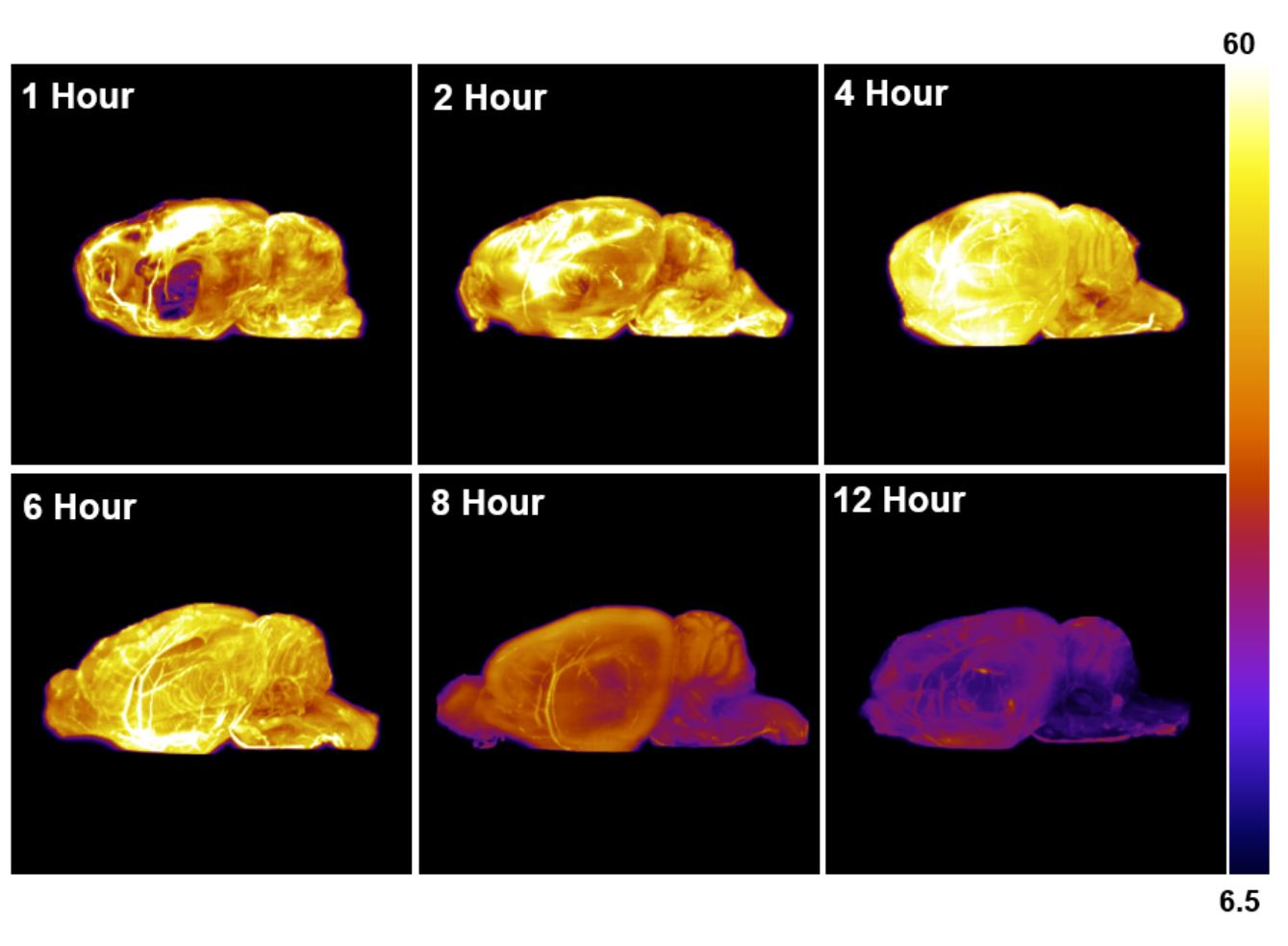 What is CryoFluorescence Tomography?