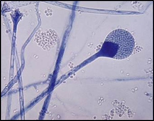 Figure 3. The Apophysomyces trapeziformis fungus