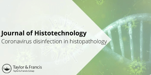 Coronavirus Disinfection