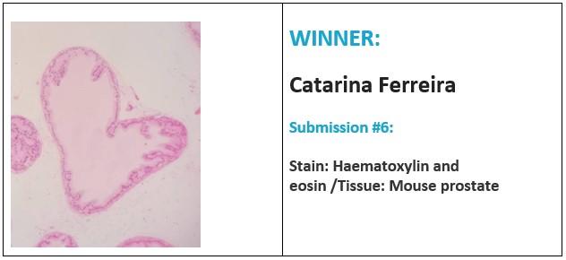 2022 Histology Professionals Day Art of the Stain Contest Winner