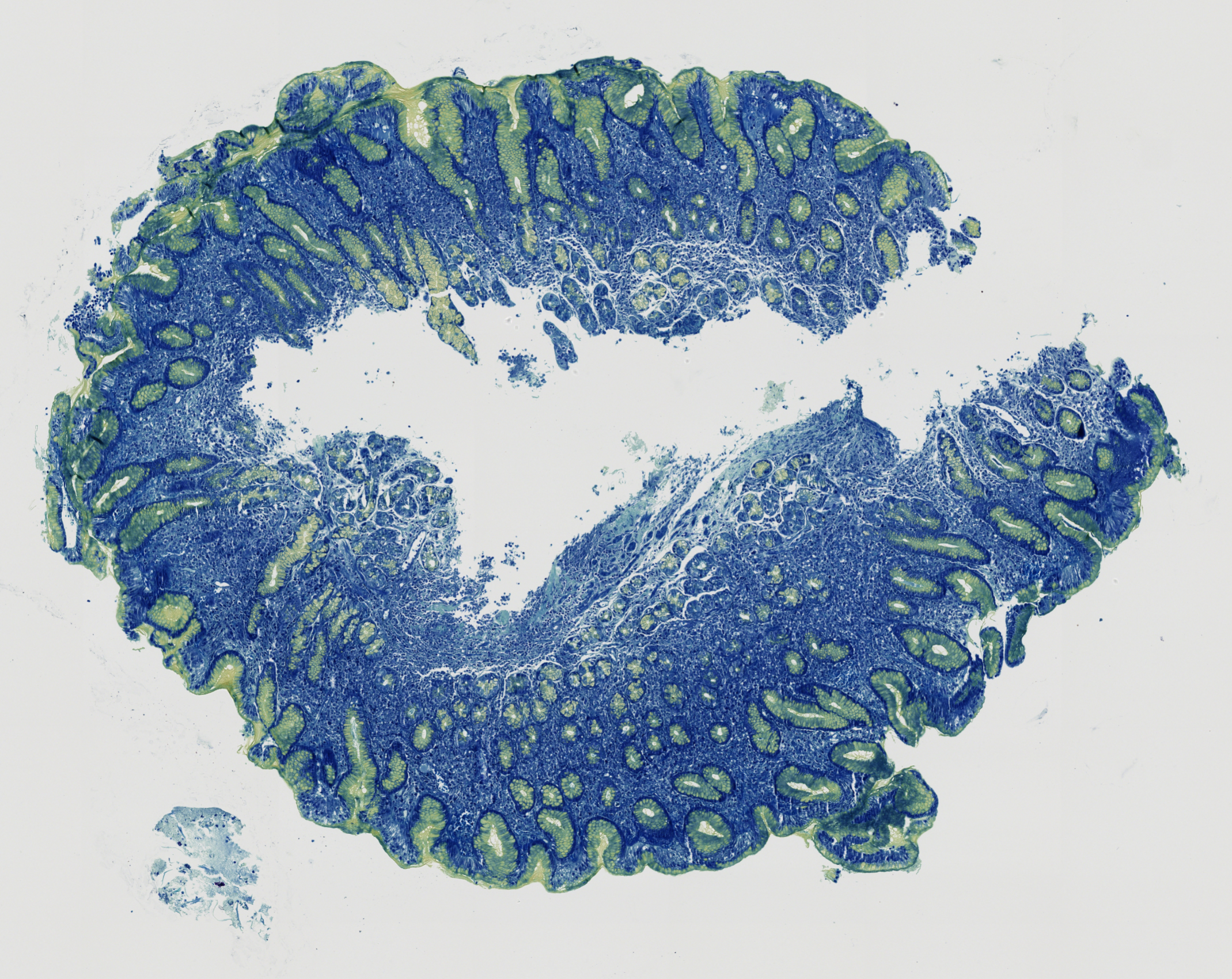 Alcian Yellow Toluidine Blue Histology Stain