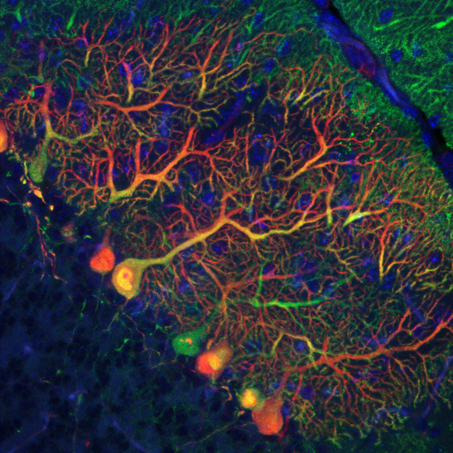 Image_36_Immunofluorescence_Cerebellum.jpg