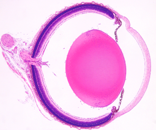 JOH Ocular Stain H&E