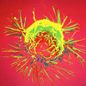 Genetic_risk_analysis_of_a_patient_with_fulminant_autoimmune_type_1_diabetes_mellitus.jpg