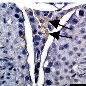 Vaccination_with_inhibin.jpg