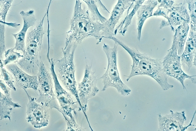 Normal_cells resized.jpg