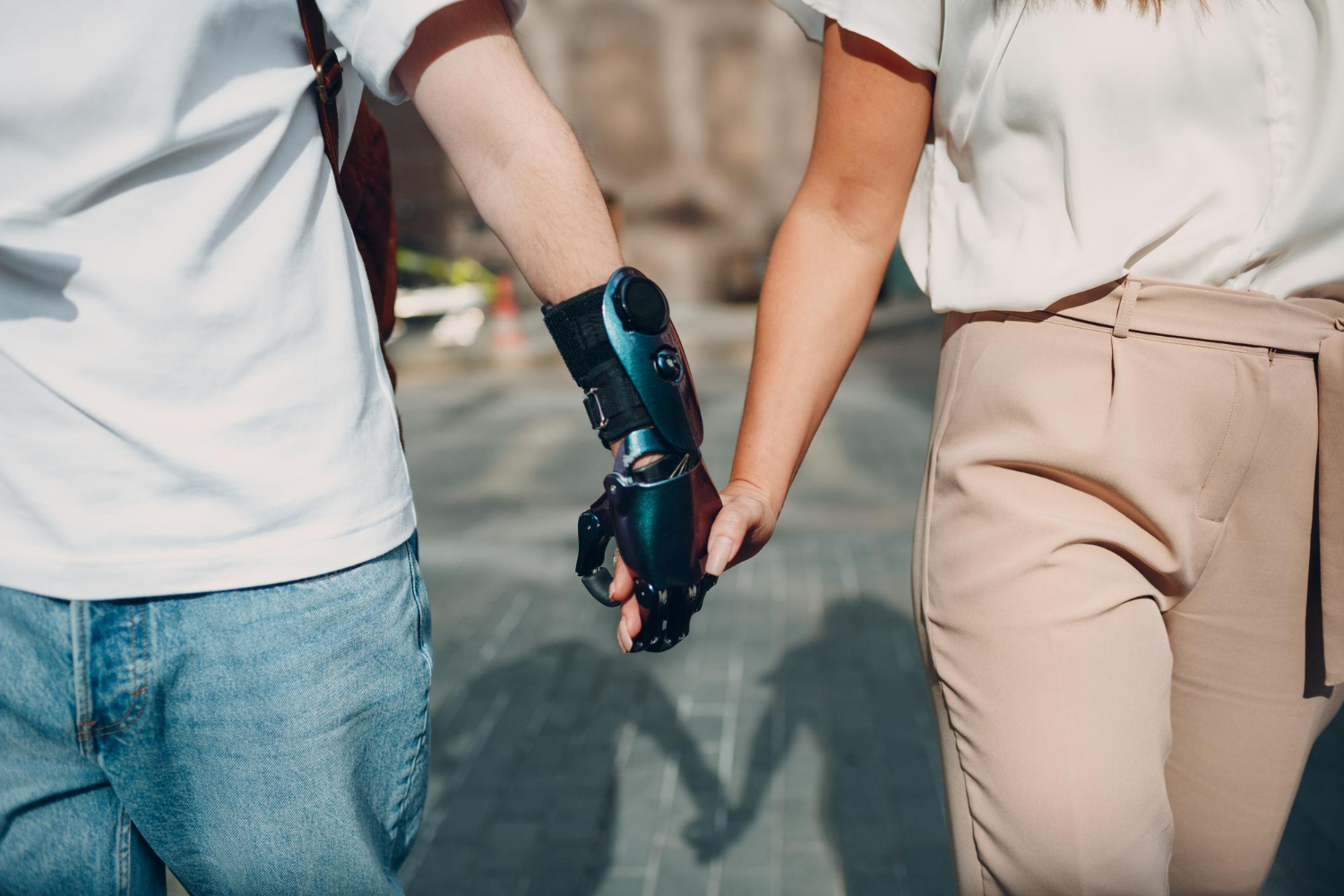 Terms and Conditions: Why Language Matters After Limb Loss